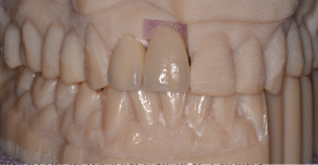 Imagen de Estética dental