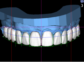 Imagen de Estética dental