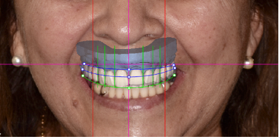 Imagen de Estética dental